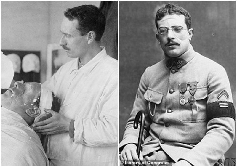 Первый после первого. Ранения солдат первой мировой войны. Пластическая хирургия первой мировой войны. Изуродованные лица солдат первой мировой войны. Ранения лица первая мировая.
