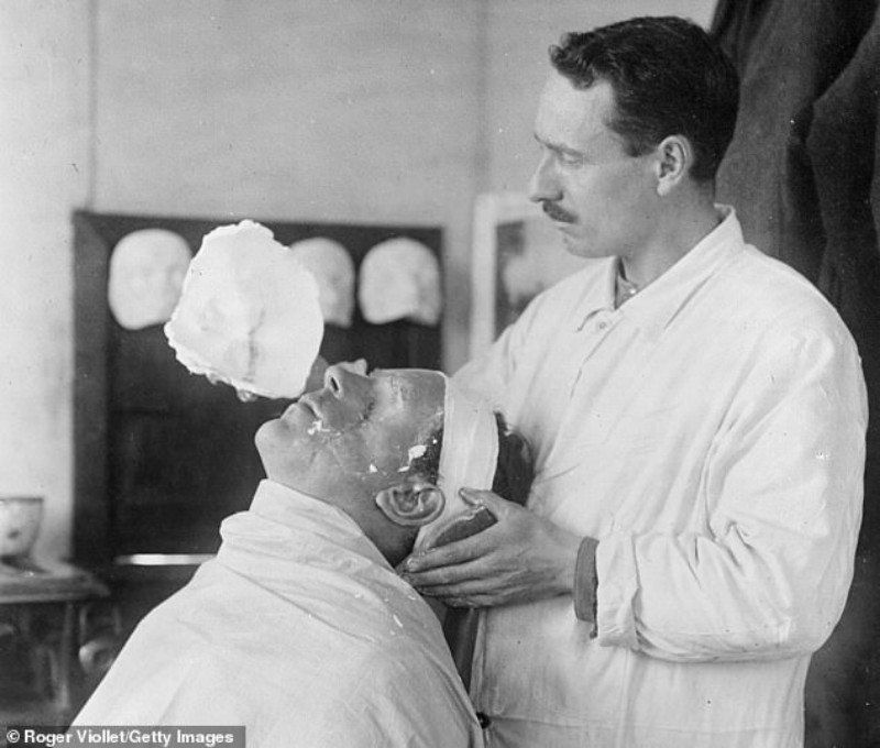 Первая операция в истории. Пластическая хирургия первой мировой войны. Гарольд Гиллис первая операция. Первые пластические операции. Протезы лица первой мировой.