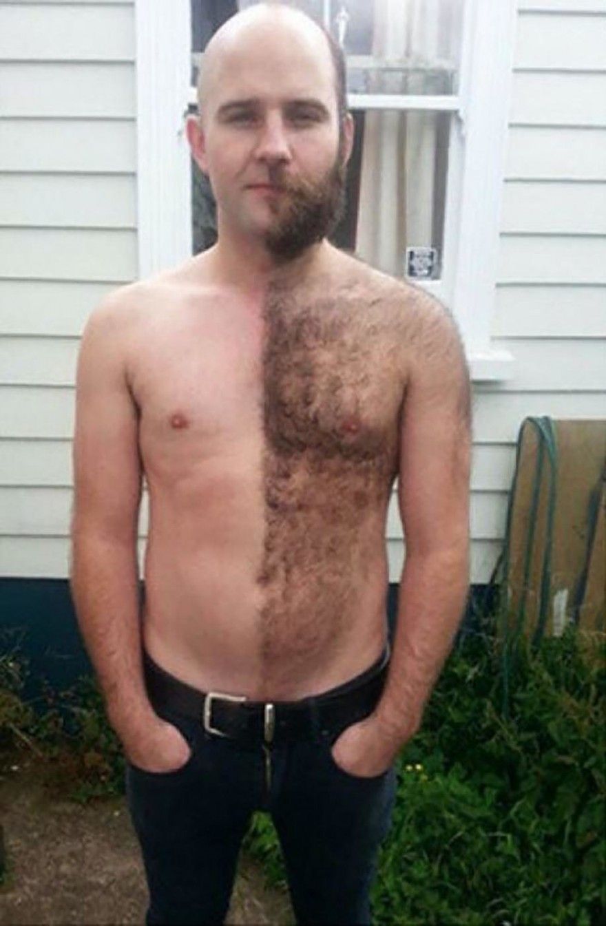как удалить волосы на груди и животе у мужчин фото 58