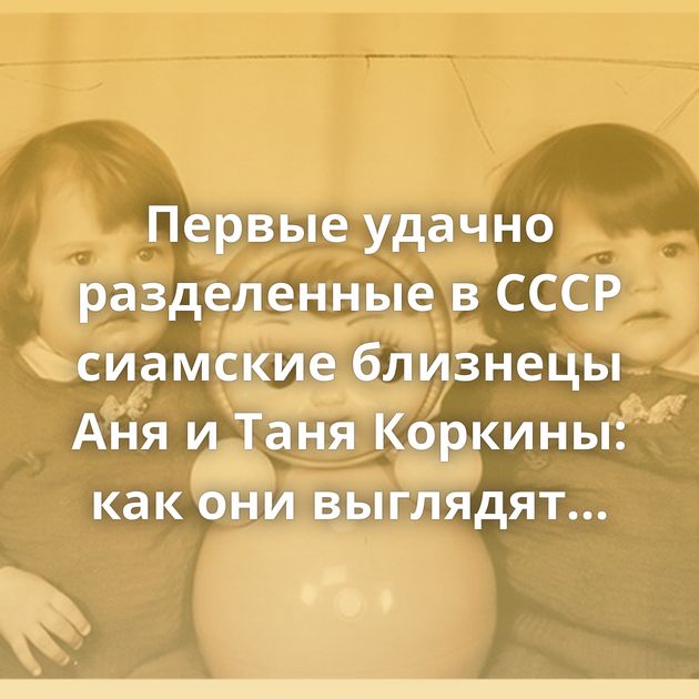 Первые удачно разделенные в СССР сиамские близнецы Аня и Таня Коркины: как они выглядят сейчас