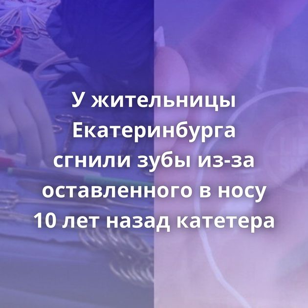 У жительницы Екатеринбурга сгнили зубы из-за оставленного в носу 10 лет назад катетера