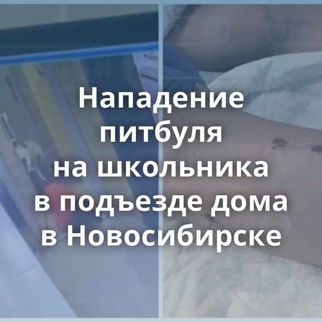 Нападение питбуля на школьника в подъезде дома в Новосибирске