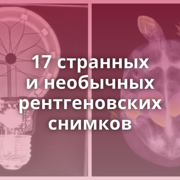 17 странных и необычных рентгеновских снимков