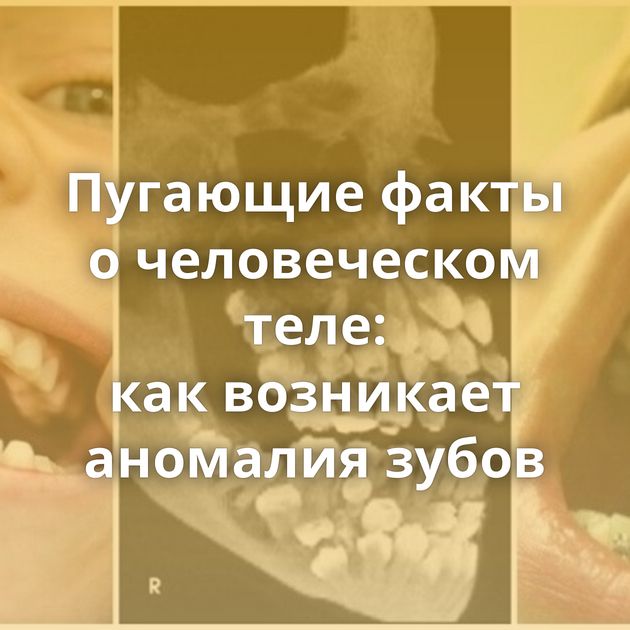 Пугающие факты о человеческом теле: как возникает аномалия зубов