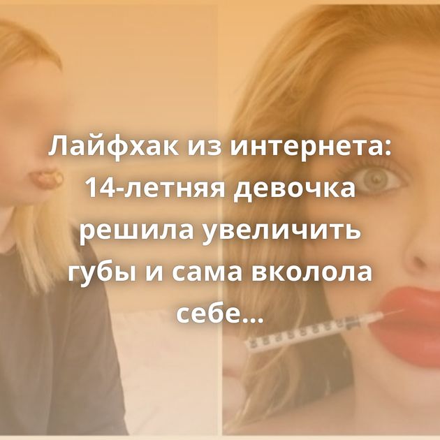 Лайфхак из интернета: 14-летняя девочка решила увеличить губы и сама вколола себе косметическое масло