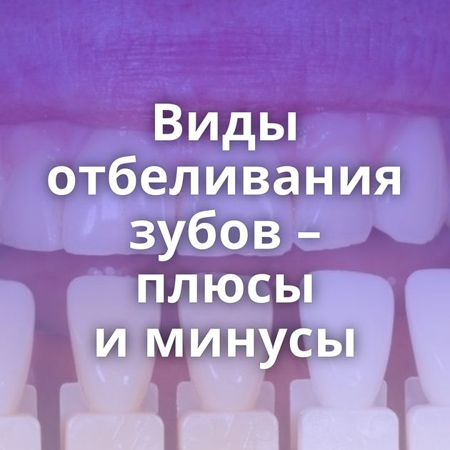 Виды отбеливания зубов – плюсы и минусы
