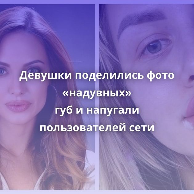 Девушки поделились фото «надувных» губ и напугали пользователей сети