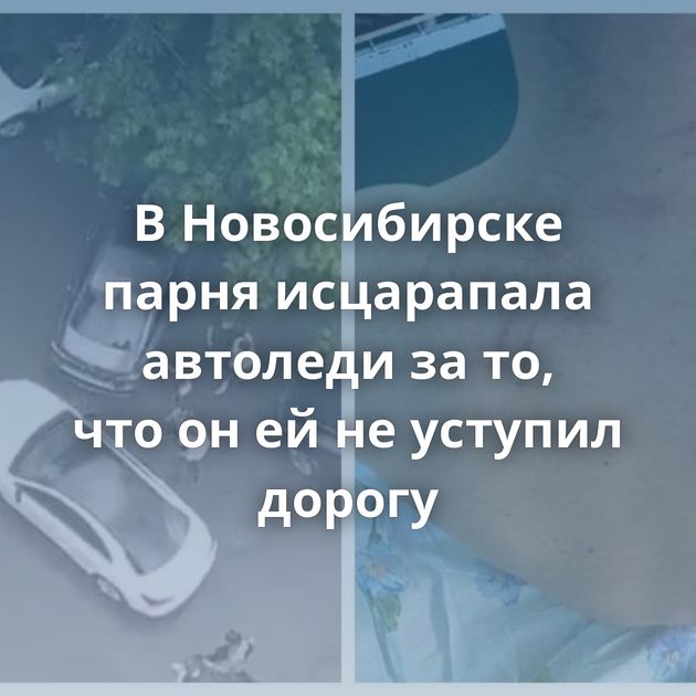 В Новосибирске парня исцарапала автоледи за то, что он ей не уступил дорогу