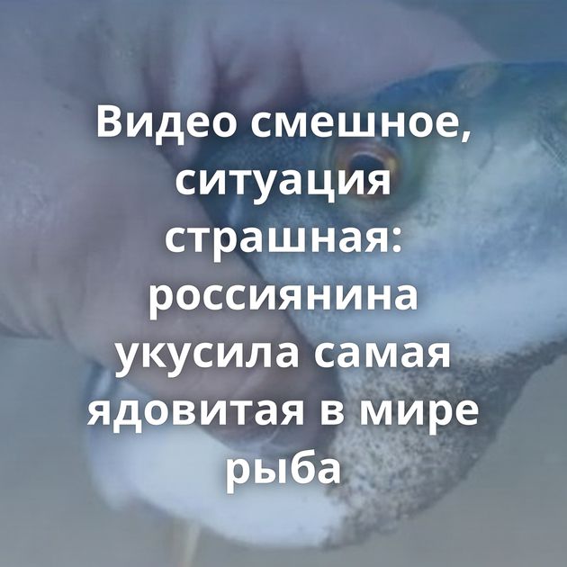 Видео смешное, ситуация страшная: россиянина укусила самая ядовитая в мире рыба