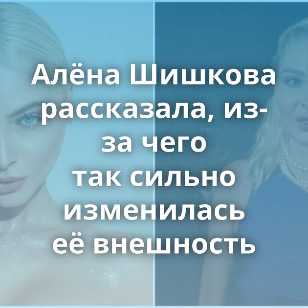Алёна Шишкова рассказала, из-за чего так сильно изменилась её внешность