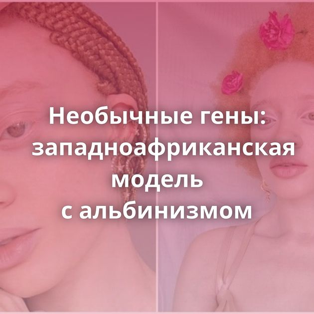 Необычные гены: западноафриканская модель с альбинизмом