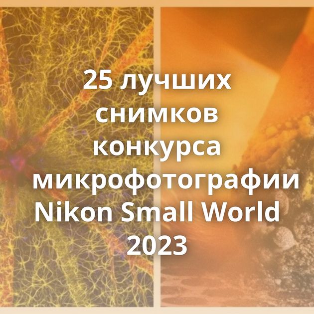 25 лучших снимков конкурса микрофотографии Nikon Small World 2023