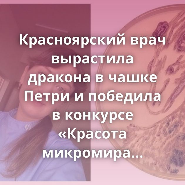 Красноярский врач вырастила дракона в чашке Петри и победила в конкурсе «Красота микромира 2023»