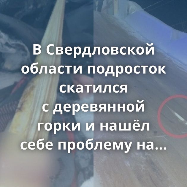 В Свердловской области подросток скатился с деревянной горки и нашёл себе проблему на пятую точку