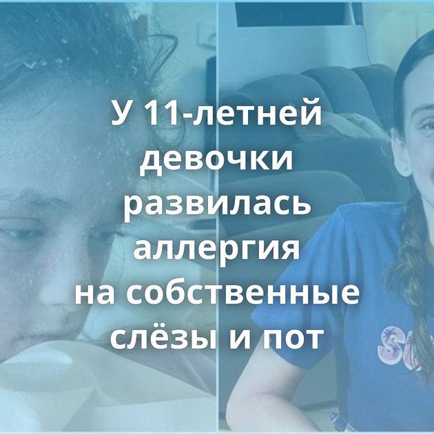 У 11-летней девочки развилась аллергия на собственные слёзы и пот