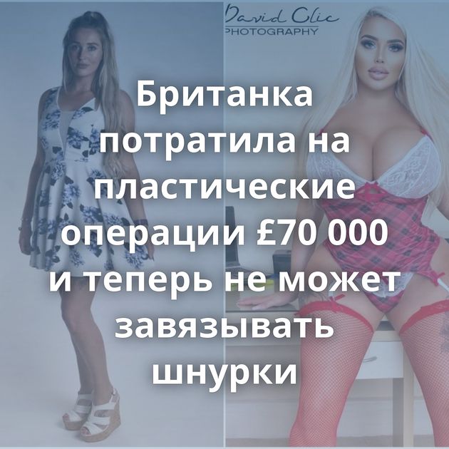 Британка потратила на пластические операции £70 000 и теперь не может завязывать шнурки