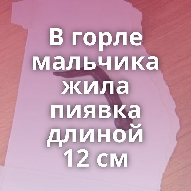 В горле мальчика жила пиявка длиной 12 см