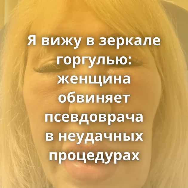 Я вижу в зеркале горгулью: женщина обвиняет псевдоврача в неудачных процедурах