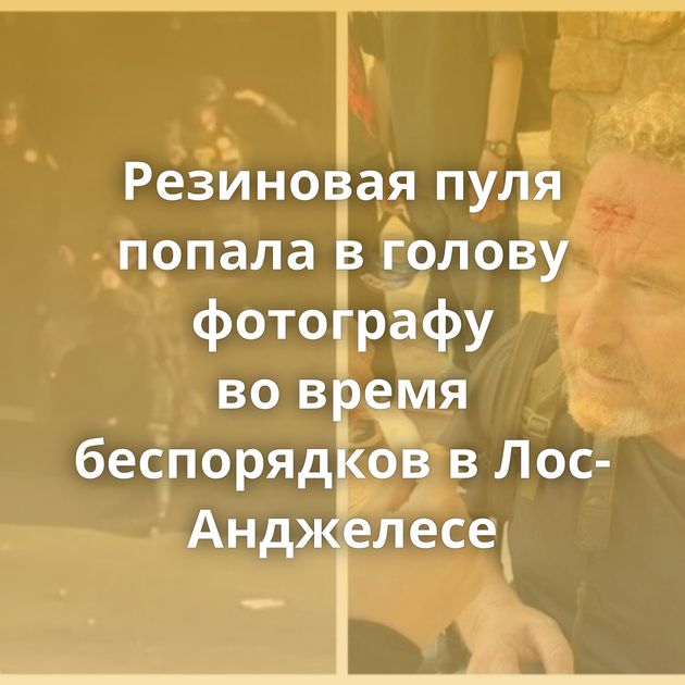 Резиновая пуля попала в голову фотографу во время беспорядков в Лос-Анджелесе