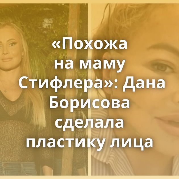 «Похожа на маму Стифлера»: Дана Борисова сделала пластику лица
