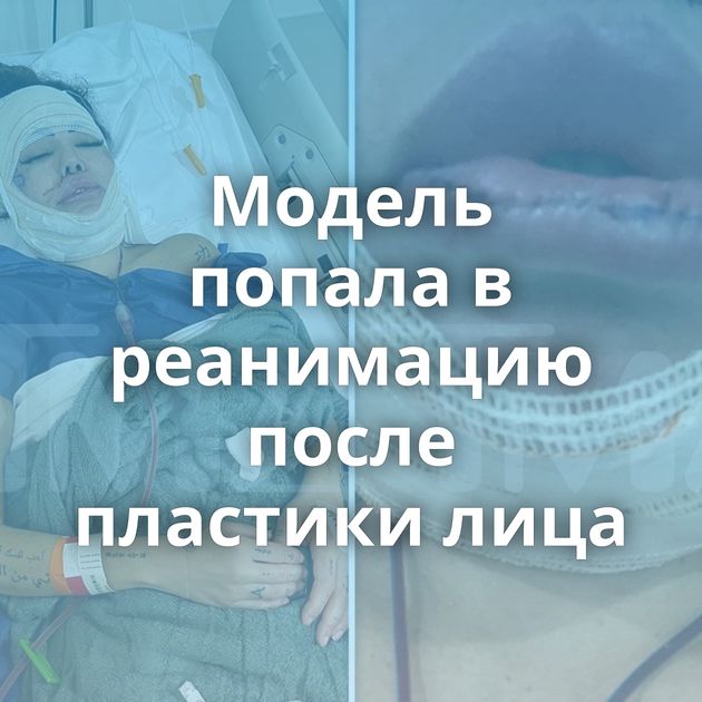 Модель попала в реанимацию после пластики лица