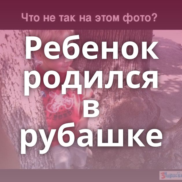 Ребенок родился в рубашке