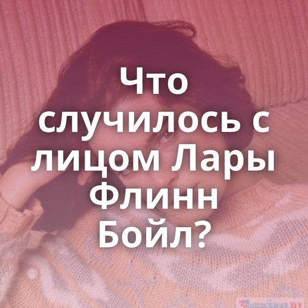 Что случилось с лицом Лары Флинн Бойл?