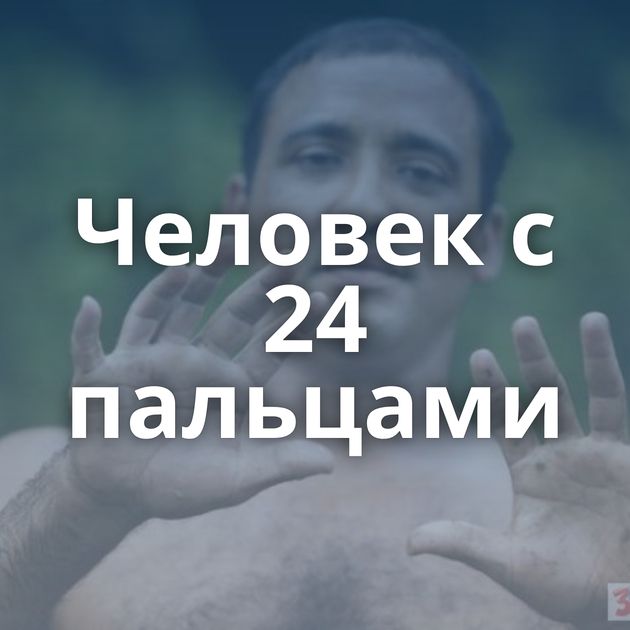 Человек с 24 пальцами