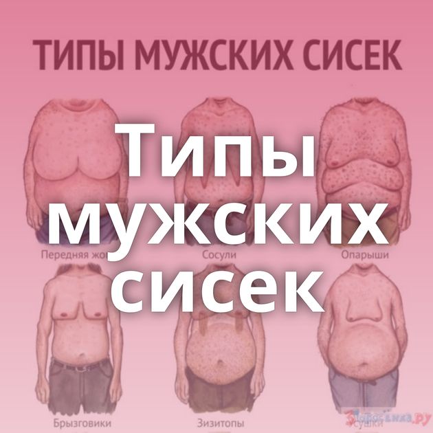 Типы мужских сисек