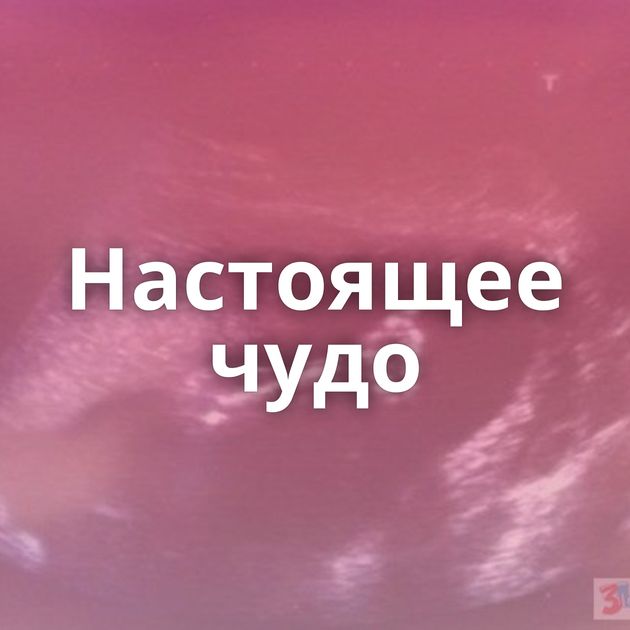 Настоящее чудо