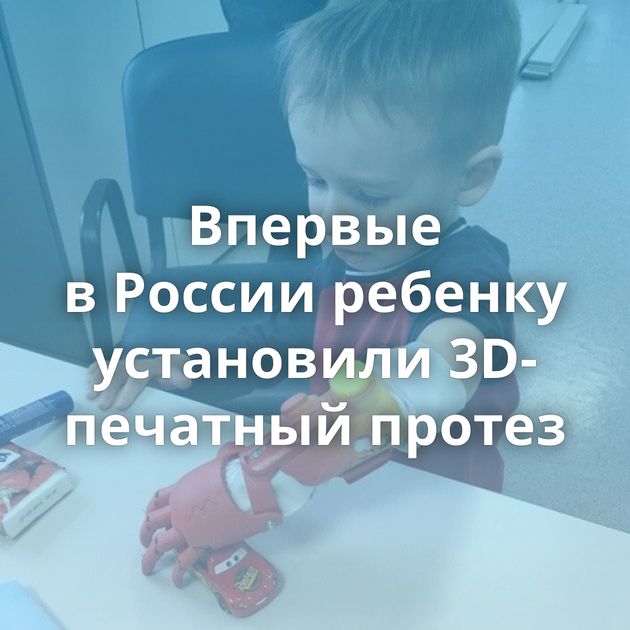 Впервые в России ребенку установили 3D-печатный протез