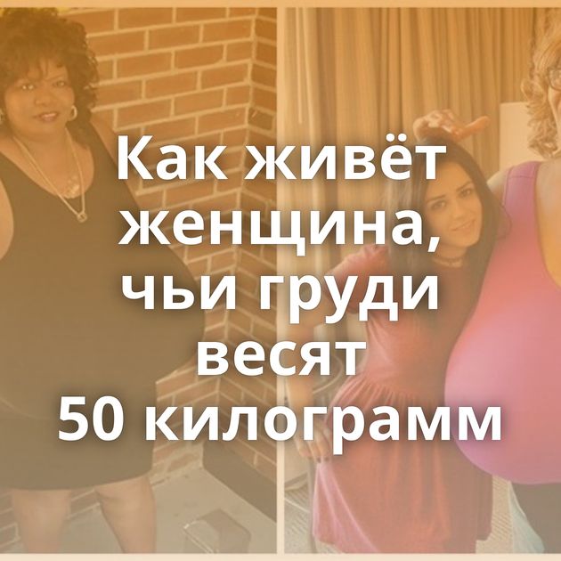 Как живёт женщина, чьи груди весят 50 килограмм