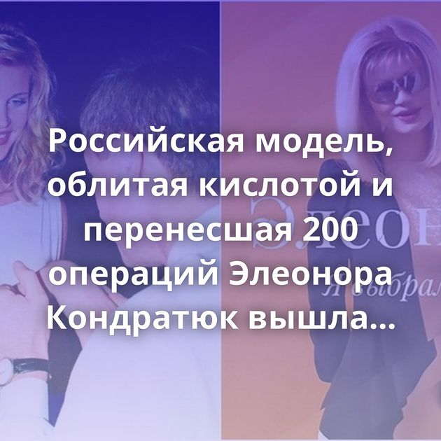 Российская модель, облитая кислотой и перенесшая 200 операций Элеонора Кондратюк вышла замуж