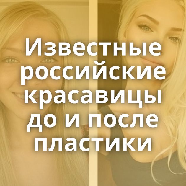 Известные российские красавицы до и после пластики