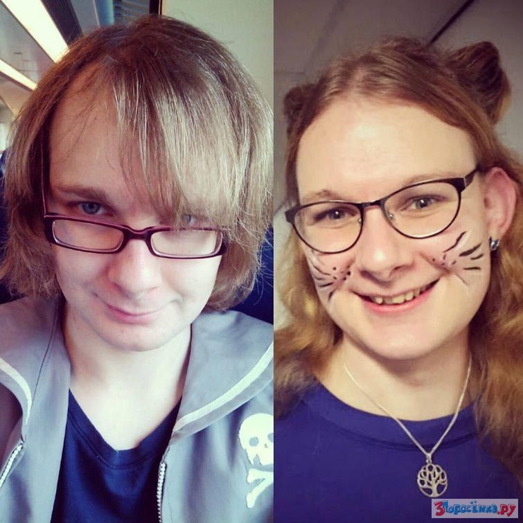 День трансгендеров 31. Трансгендеры до и после. Трансгендерный фото реальные. Трансформация лица.