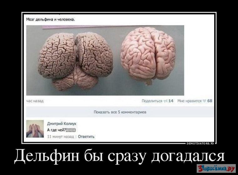 Глупые мозги. Шутки про мозг.