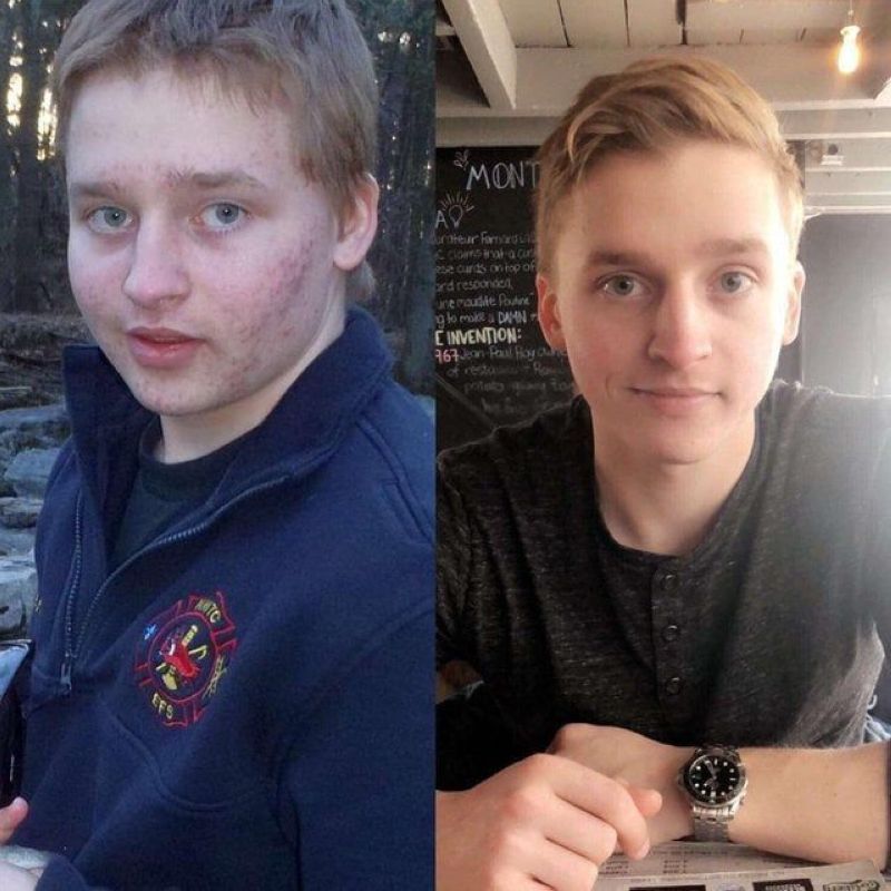 После переходного возраста. Подростки до и после. Парни до переходного возраста и после. Некрасивые парни до и после. До и после подросткового возраста.